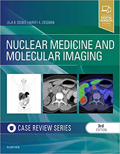 پزشکی هسته ای و تصویربرداری مولکولی: سری موارد بررسی - رادیولوژی